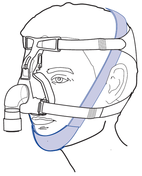 resmedchin2.png